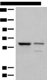 HNF1A / HNF1 Antibody - Western blot analysis of Human left kidney cancer tissue and HEPG2 cell lysates  using HNF1A Polyclonal Antibody at dilution of 1:200