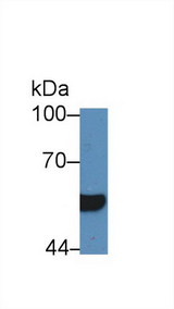 HNF1B / HNF1 Beta Antibody - Western Blot; Sample: Human Serum; Primary Ab: 5µg/ml Rabbit Anti-Human HNF1b Antibody Second Ab: 0.2µg/mL HRP-Linked Caprine Anti-Rabbit IgG Polyclonal Antibody