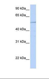 HNF1B / HNF1 Beta Antibody - 721_B cell lysate. Antibody concentration: 1.0 ug/ml. Gel concentration: 12%.  This image was taken for the unconjugated form of this product. Other forms have not been tested.
