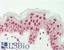 HNF1B / HNF1 Beta Antibody - Human Skin: Formalin-Fixed, Paraffin-Embedded (FFPE)