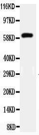 HNF1B / HNF1 Beta Antibody - WB of HNF1B / TCF2 antibody. All lanes: Anti-HNF1B at 0.5ug/ml. Lane 1: Mouse Liver Tissue Lysate at 40ug. Predicted bind size: 61KD. Observed bind size: 61KD.