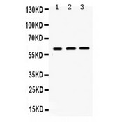 HNF1B / HNF1 Beta Antibody - HNF1 beta antibody Western blot. All lanes: Anti HNF1 beta at 0.5 ug/ml. Lane 1: Rat Liver Tissue Lysate at 50 ug. Lane 2: Rat Kidney Tissue Lysate at 50 ug. Lane 3: SW620 Whole Cell Lysate at 40 ug. Predicted band size: 61 kD. Observed band size: 61 kD.