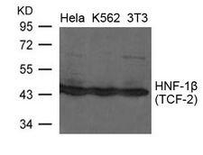 HNF1B / HNF1 Beta Antibody - Western blot of extracts from HeLa, K562 and 3T3 cells using HNF-1b(TCF-2) Antibody