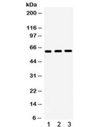 HNF1B / HNF1 Beta Antibody