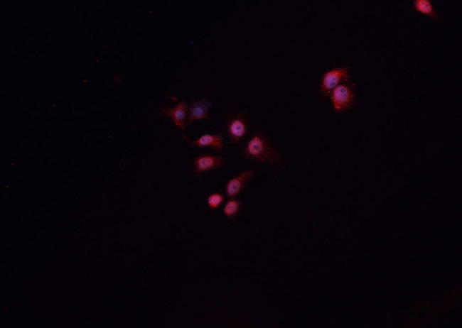 HNF1B / HNF1 Beta Antibody - Staining A549 cells by IF/ICC. The samples were fixed with PFA and permeabilized in 0.1% Triton X-100, then blocked in 10% serum for 45 min at 25°C. The primary antibody was diluted at 1:200 and incubated with the sample for 1 hour at 37°C. An Alexa Fluor 594 conjugated goat anti-rabbit IgG (H+L) antibody, diluted at 1/600, was used as secondary antibody.
