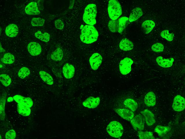 HNF1B / HNF1 Beta Antibody - Immunofluorescence staining of HNF1B in CACO-2 cells. Cells were fixed with 4% PFA, permeabilzed with 0.1% Triton X-100 in PBS, blocked with 10% serum, and incubated with rabbit anti-Human HNF1B polyclonal antibody (dilution ratio 1:200) at 4°C overnight. Then cells were stained with the Alexa Fluor 488-conjugated Goat Anti-rabbit IgG secondary antibody (green). Positive staining was localized to Nucleus.