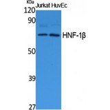 HNF1B / HNF1 Beta Antibody - Western blot of HNF-1beta antibody