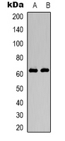 HNF1B / HNF1 Beta Antibody - Western blot analysis of HNF1 beta expression in Jurkat (A); K562 (B) whole cell lysates.