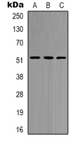 HNF4 Alpha+Gamma Antibody - Western blot analysis of HNF4 alpha/gamma expression in A549 (A); HepG2 (B); HeLa (C) whole cell lysates.