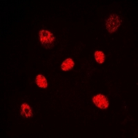 HNF4 Alpha+Gamma Antibody - Immunofluorescent analysis of HNF4 alpha/gamma staining in HeLa cells. Formalin-fixed cells were permeabilized with 0.1% Triton X-100 in TBS for 5-10 minutes and blocked with 3% BSA-PBS for 30 minutes at room temperature. Cells were probed with the primary antibody in 3% BSA-PBS and incubated overnight at 4 deg C in a humidified chamber. Cells were washed with PBST and incubated with a DyLight 594-conjugated secondary antibody (red) in PBS at room temperature in the dark. DAPI was used to stain the cell nuclei (blue).