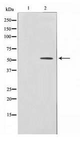 HNF4 Alpha+Gamma Antibody - Western blot of HepG2 cell lysate using HNF4alpha /gamma Antibody