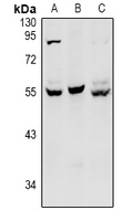 HNF4 Alpha+Gamma Antibody - Western blot analysis of HNF4 alpha/gamma expression in HCT116 (A), CT26 (B), A549 (C) whole cell lysates.