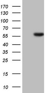 HNF4A / HNF4 Antibody - HEK293T cells were transfected with the pCMV6-ENTRY control. (Left lane) or pCMV6-ENTRY HNF4A. (Right lane) cDNA for 48 hrs and lysed. Equivalent amounts of cell lysates. (5 ug per lane) were separated by SDS-PAGE and immunoblotted with anti-HNF4A.