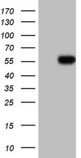HNF4A / HNF4 Antibody - HEK293T cells were transfected with the pCMV6-ENTRY control (Left lane) or pCMV6-ENTRY HNF4A (Right lane) cDNA for 48 hrs and lysed. Equivalent amounts of cell lysates (5 ug per lane) were separated by SDS-PAGE and immunoblotted with anti-HNF4A.