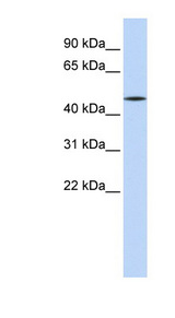 HNF4A / HNF4 Antibody - HNF4A / HNF4 antibody Western blot of HeLa lysate. This image was taken for the unconjugated form of this product. Other forms have not been tested.