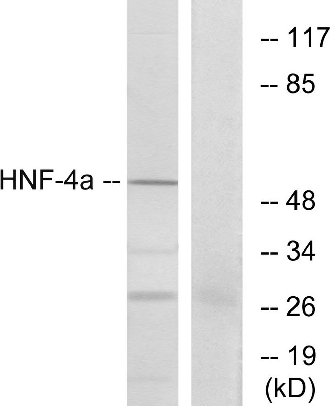 HNF4A / HNF4 Antibody - Western blot analysis of the lysates from HepG2 cells using HNF4Î± antibody.
