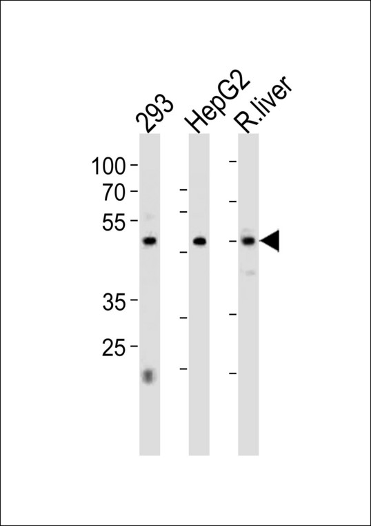 HNF4A / HNF4 Antibody - HNF4A Antibody western blot of 293,HepG2 cell line and rat liver tissue lysates (35 ug/lane). The HNF4A antibody detected the HNF4A protein (arrow).