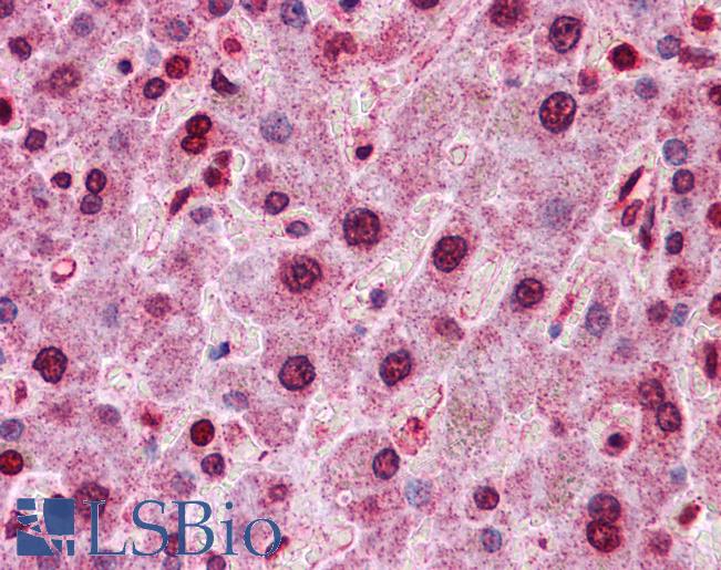 HNF4A / HNF4 Antibody - Anti-HNF4A / HNF4 antibody IHC of human liver. Immunohistochemistry of formalin-fixed, paraffin-embedded tissue after heat-induced antigen retrieval. Antibody concentration 5 ug/ml.  This image was taken for the unconjugated form of this product. Other forms have not been tested.