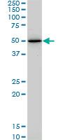 HNF4A / HNF4 Antibody - HNF4A monoclonal antibody (M04), clone 4E2. Western Blot analysis of HNF4A expression in Jurkat.