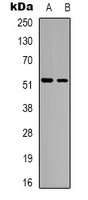 HNF4A / HNF4 Antibody - Western blot analysis of HNF4 alpha expression in HT29 (A); rat muscle (B) whole cell lysates.