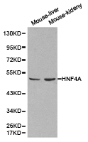 HNF4A / HNF4 Antibody - Western blot of extracts of various cell lines, using HNF4A antibody.