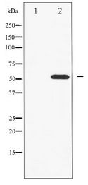 HNF4A / HNF4 Antibody - Western blot of HNF4 alpha expression in HT29 whole cell lysates,The lane on the left is treated with the antigen-specific peptide