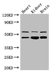HNF4A / HNF4 Antibody - Positive WB detected in:Mouse heart tissue,,Mouse kidney tissue,Mouse brain tissue;All lanes: HNF4A antibody at 3ug/ml;Secondary;Goat polyclonal to rabbit IgG at 1/50000 dilution;Predicted band size: 53,52,47,57,51,49,44 kDa;Observed band size: 53,47 kDa;
