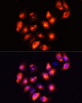 HNF4A / HNF4 Antibody - Immunofluorescence analysis of HeLa cells using HNF4a antibody at dilution of 1:100 (40x lens). Blue: DAPI for nuclear staining.