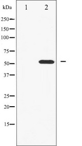 HNF4A / HNF4 Antibody - Western blot analysis of HNF4 alpha expression in HT29 whole cells lysates. The lane on the left is treated with the antigen-specific peptide.