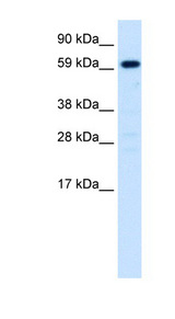HNF4A / HNF4 Antibody - HNF4A / HNF4 antibody Western blot of Fetal liver lysate. This image was taken for the unconjugated form of this product. Other forms have not been tested.