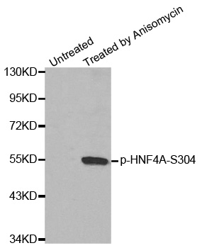 HNF4A / HNF4 Antibody - Western blot analysis of extracts from Hela cells.