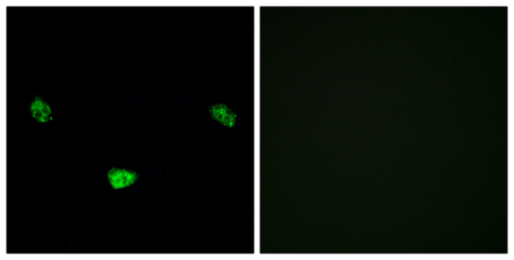 HNF4A / HNF4 Antibody - Immunofluorescence analysis of LOVO cells, using HNF4 alpha (Phospho-Ser313) Antibody. The picture on the right is blocked with the phospho peptide.