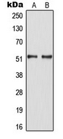 HNF4A / HNF4 Antibody - Western blot analysis of HNF4 alpha (pS313) expression in SW480 (A); HepG2 EGF-treated (B) whole cell lysates.