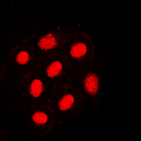 HNF4A / HNF4 Antibody - Immunofluorescent analysis of HNF4 alpha (pS313) staining in SW480 cells. Formalin-fixed cells were permeabilized with 0.1% Triton X-100 in TBS for 5-10 minutes and blocked with 3% BSA-PBS for 30 minutes at room temperature. Cells were probed with the primary antibody in 3% BSA-PBS and incubated overnight at 4 C in a humidified chamber. Cells were washed with PBST and incubated with a DyLight 594-conjugated secondary antibody (red) in PBS at room temperature in the dark. DAPI was used to stain the cell nuclei (blue).
