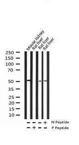 HNF4A / HNF4 Antibody - Western blot analysis of Phospho-HNF4 alpha (Ser313) expression in various lysates