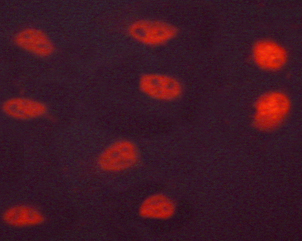 HNF4A / HNF4 Antibody - Staining LOVO cells by IF/ICC. The samples were fixed with PFA and permeabilized in 0.1% saponin prior to blocking in 10% serum for 45 min at 37°C. The primary antibody was diluted 1/400 and incubated with the sample for 1 hour at 37°C. A Alexa Fluor 594 conjugated goat polyclonal to rabbit IgG (H+L), diluted 1/600 was used as secondary antibody.