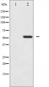 HNF4A / HNF4 Antibody - Western blot analysis of HNF4 alpha phosphorylation expression in EGF treated HuvEc whole cells lysates. The lane on the left is treated with the antigen-specific peptide.