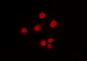 HNF4A / HNF4 Antibody - Staining HT29 cells by IF/ICC. The samples were fixed with PFA and permeabilized in 0.1% Triton X-100, then blocked in 10% serum for 45 min at 25°C. The primary antibody was diluted at 1:200 and incubated with the sample for 1 hour at 37°C. An Alexa Fluor 594 conjugated goat anti-rabbit IgG (H+L) Ab, diluted at 1/600, was used as the secondary antibody.