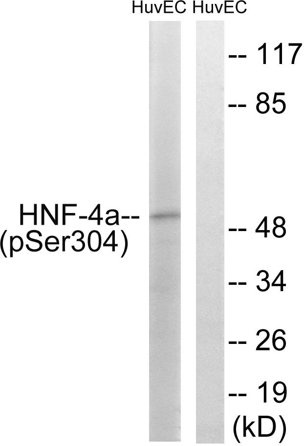 HNF4A / HNF4 Antibody - Western blot analysis of extracts from HUVEC cells, treated with EGF (200ng/ml, 30mins), using HNF4a (Phospho-Ser313) antibody.