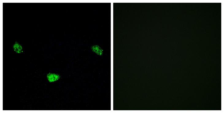 HNF4A / HNF4 Antibody - P-peptide - + Immunofluorescence analysis of LOVO cells, using HNF4a (Phospho-Ser313) antibody.