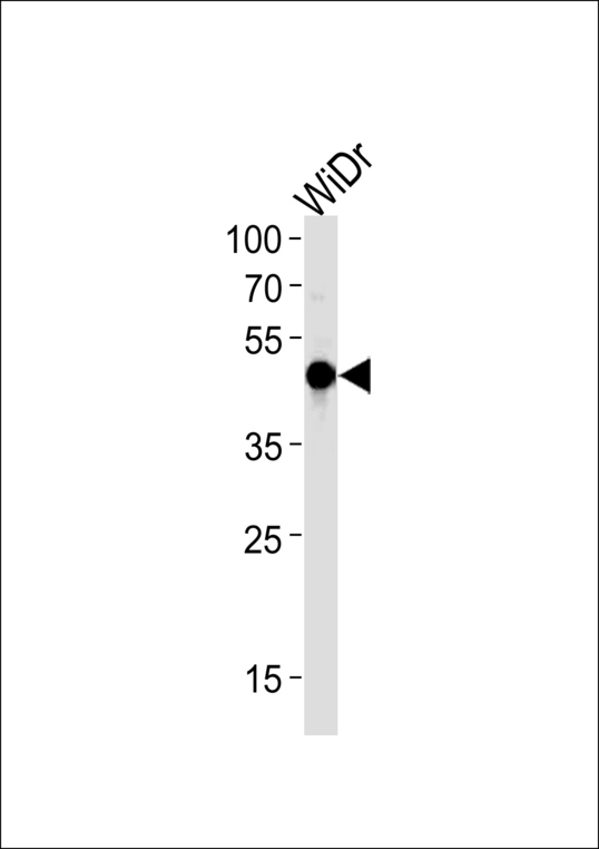 HNF4G / HNF4 Gamma Antibody - HNF4G Antibody western blot of WiDr cell line lysates (35 ug/lane). The HNF4G antibody detected the HNF4G protein (arrow).