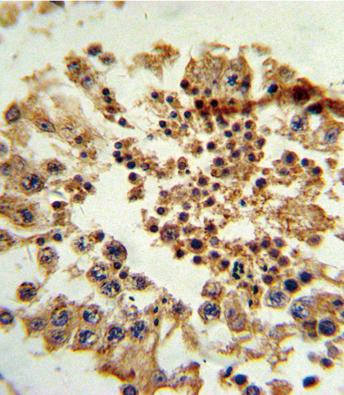 HNF4G / HNF4 Gamma Antibody - Formalin-fixed and paraffin-embedded human testis tissue reacted with HNF4G Antibody , which was peroxidase-conjugated to the secondary antibody, followed by DAB staining. This data demonstrates the use of this antibody for immunohistochemistry; clinical relevance has not been evaluated.