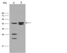 HNF4G / HNF4 Gamma Antibody - Anti-HNF4G rabbit polyclonal antibody at 1:500 dilution. Lane A: Mouse stomach tissue lysate. Lane B: Mouse spleen tissue lysate. Lysates/proteins at 30 ug per lane. Secondary: Goat Anti-Rabbit IgG (H+L)/HRP at 1/10000 dilution. Developed using the ECL technique. Performed under reducing conditions. Predicted band size: 46 kDa. Observed band size: 45 kDa.