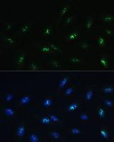 HNF4G / HNF4 Gamma Antibody - Immunofluorescence analysis of U-2OS cells using HNF4G Polyclonal Antibody at dilution of 1:100 (40x lens).Blue: DAPI for nuclear staining.
