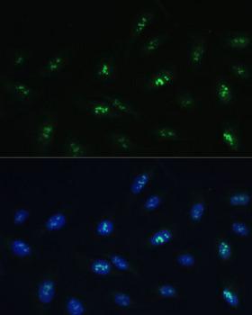 HNF4G / HNF4 Gamma Antibody - Immunofluorescence analysis of U-2OS cells using HNF4G Polyclonal Antibody at dilution of 1:100 (40x lens).Blue: DAPI for nuclear staining.