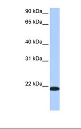 HNLF / TMED4 Antibody - Liver cell lysate. Antibody concentration: 0.5 ug/ml. Gel concentration: 12%.  This image was taken for the unconjugated form of this product. Other forms have not been tested.