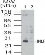 HNLF / TMED4 Antibody - Western blot of HNLF in HL60 cell lysates using antibody at 2 ug/ml. Lane 1: Unabsorbed antibody, Lane 2: Blocked with immunizing peptide.