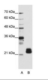 HNLF / TMED4 Antibody - B: HepG2 Cell Lysate.  This image was taken for the unconjugated form of this product. Other forms have not been tested.