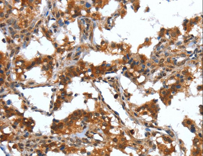 HNP-4 / DEFA4 Antibody - Immunohistochemistry of paraffin-embedded Human brain using DEFA4 Polyclonal Antibody at dilution of 1:40.
