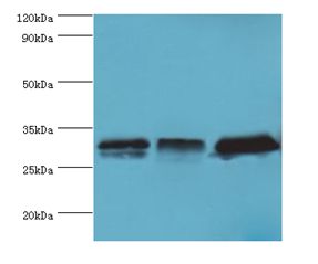 HnRNP A0 Antibody - Western blot. All lanes: HNRNPA0 antibody at 12 ug/ml. Lane 1: mouse brain tissue. Lane 2: HeLa whole cell lysate. Lane 3: Jurkat whole cell lysate. Secondary antibody: Goat polyclonal to rabbit at 1:10000 dilution. Predicted band size: 31 kDa. Observed band size: 31 kDa.